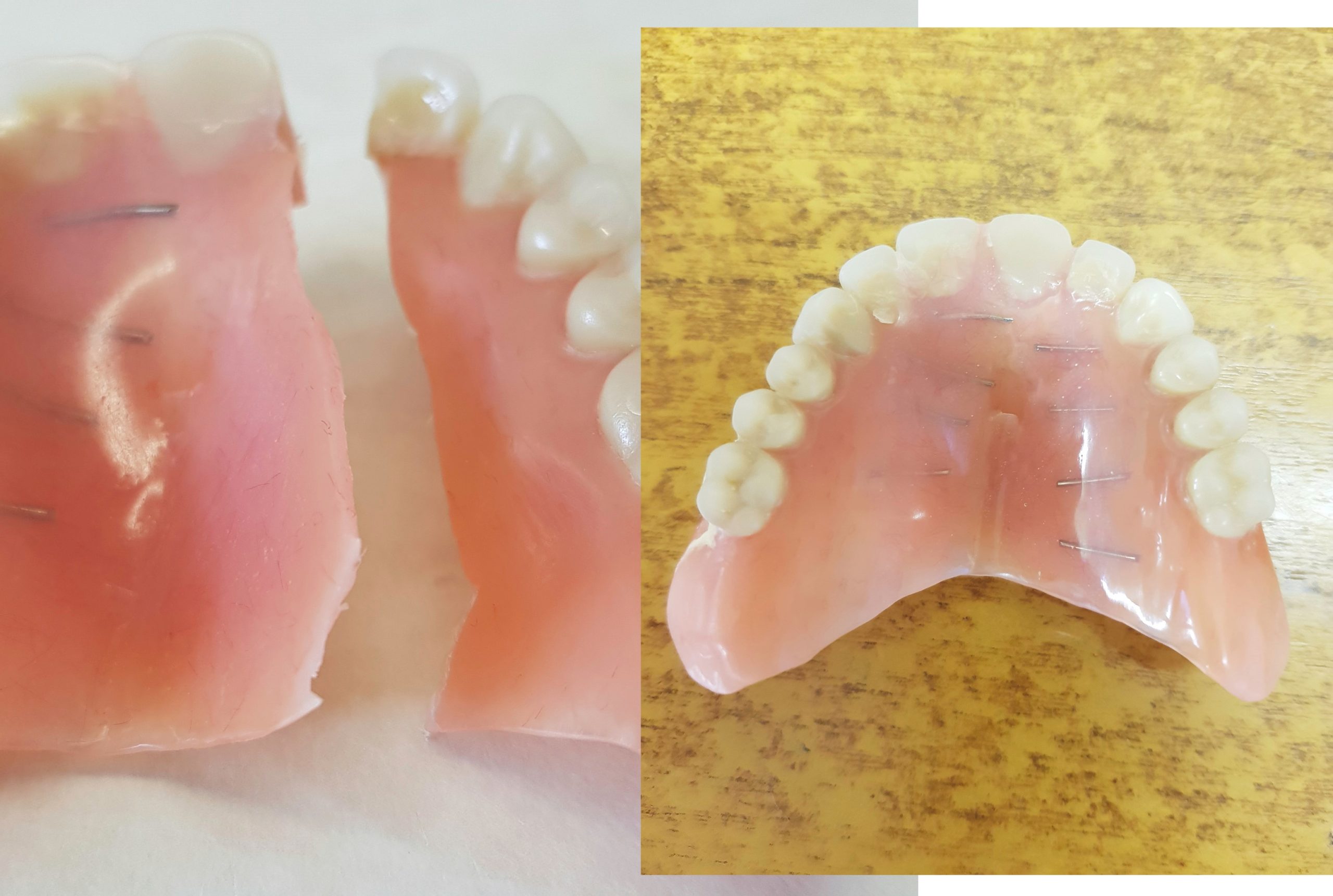 Denture repairs while you wait in and around Leicester